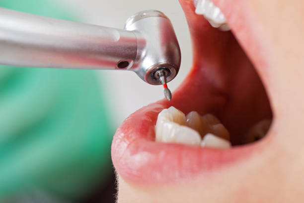 Best Affordable Emergency Dental Care  in Brooksville, MS